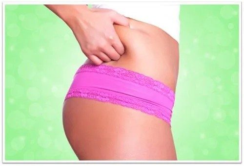 Laser Liposuction