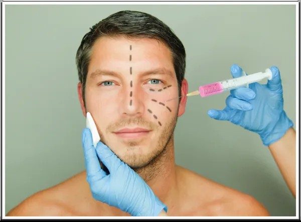 Botox For Men