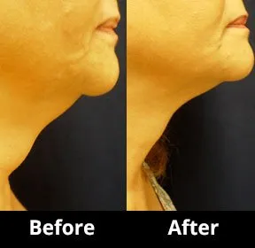 Face and Body Sculpting 6