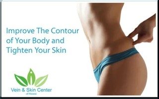 SmartLipo: Head into Summer with Confidence