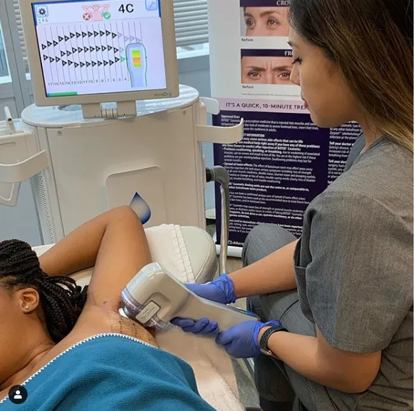 Before and After Image: miraDry - front