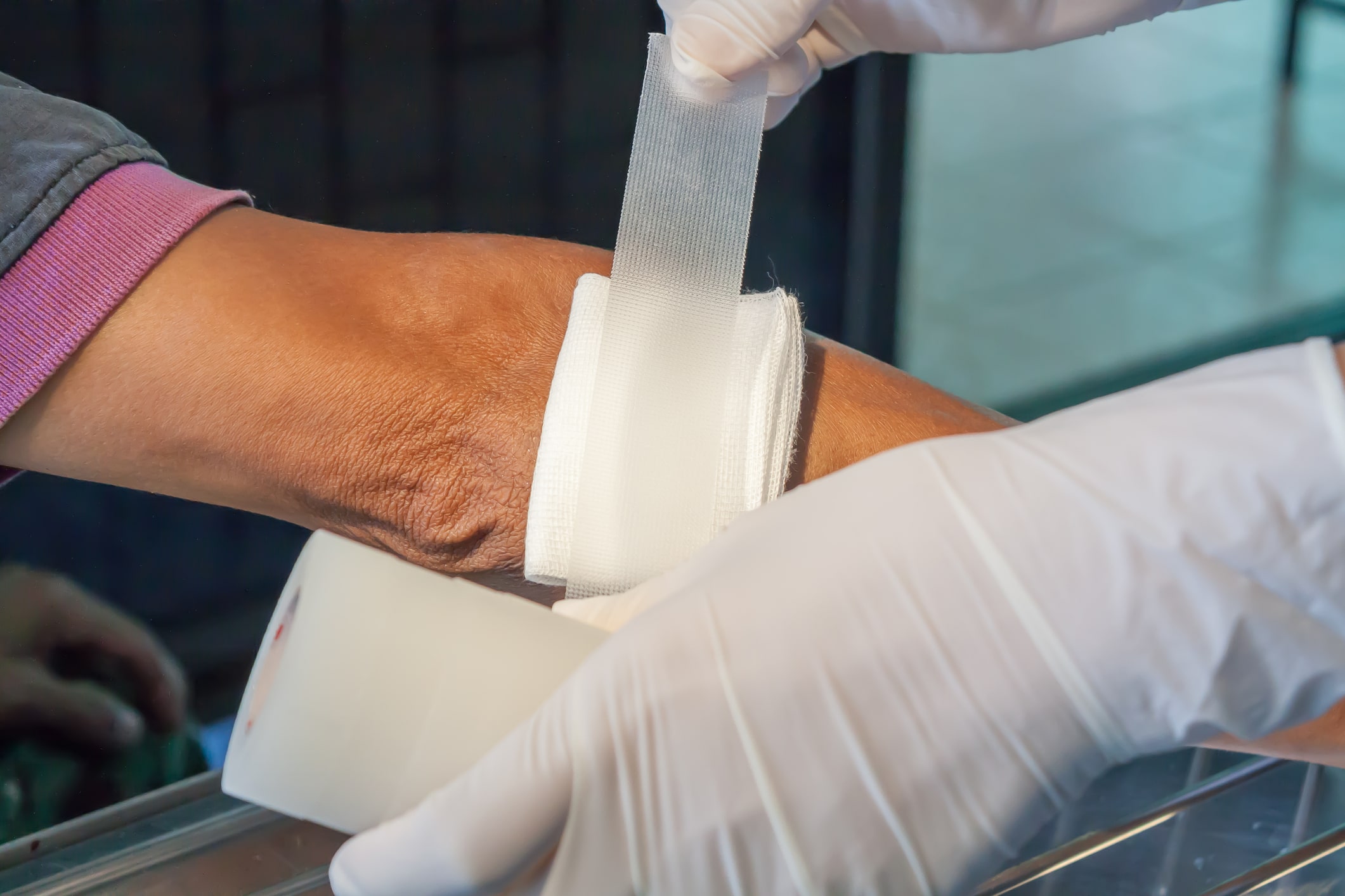 Close up of a doctor providing wound care to an elderly patient suffering from chronic vein wounds.